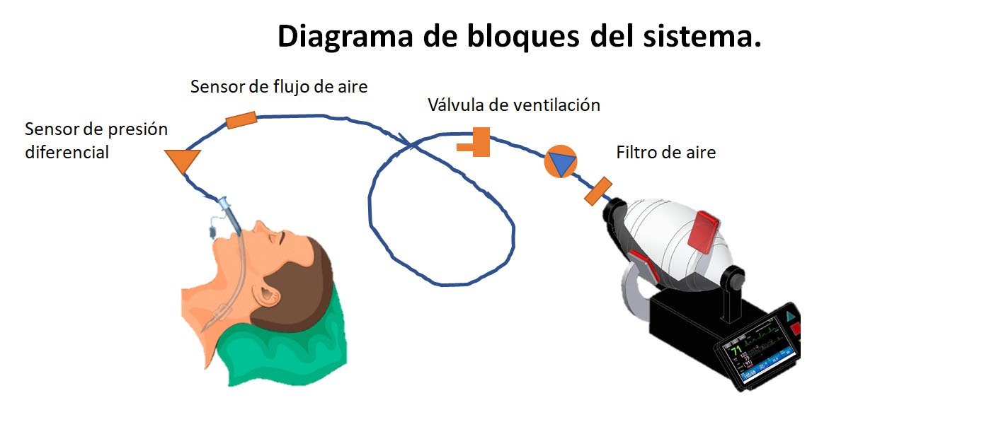 bloques del sistema